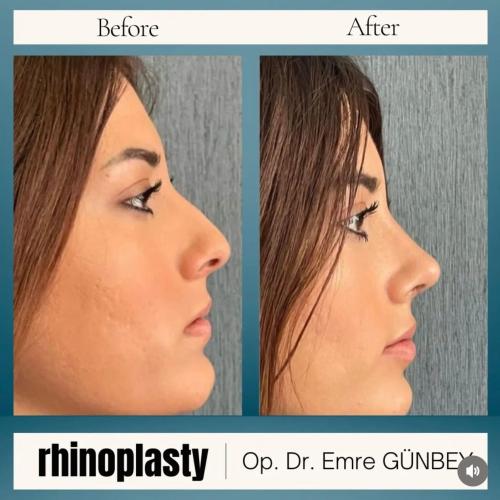 Before after photos of our patients 11